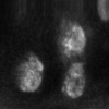 mhtml:file://C:\Documents%20and%20Settings\brian\Desktop\brianwebsite\docs\LiveMicroImagingwithOptiScanStratum.mht!http://www.lawrenz.com/images/stratum_papillary_dermis_thumb.jpg