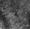mhtml:file://C:\Documents%20and%20Settings\brian\Desktop\brianwebsite\docs\LiveMicroImagingwithOptiScanStratum.mht!http://www.lawrenz.com/images/stratum_basale_thumb.jpg
