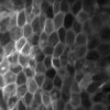 mhtml:file://C:\Documents%20and%20Settings\brian\Desktop\brianwebsite\docs\LiveMicroImagingwithOptiScanStratum.mht!http://www.lawrenz.com/images/stratum_corneum_thumb.jpg