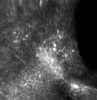 mhtml:file://C:\Documents%20and%20Settings\brian\Desktop\brianwebsite\docs\LiveMicroImagingwithOptiScanStratum.mht!http://www.lawrenz.com/images/stratum_spinosum_thumb.jpg